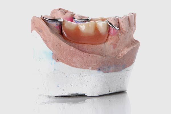 Partial Dentures Newark Delaware