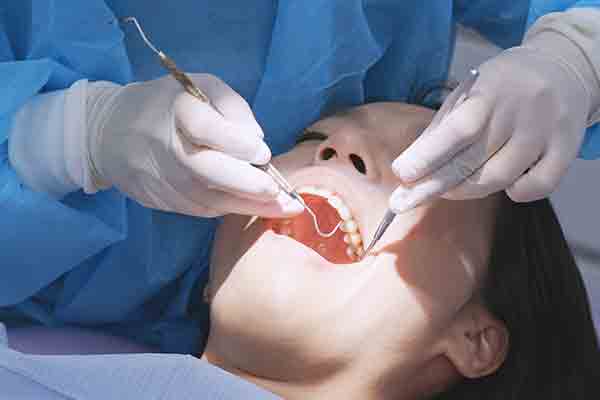 Periodontal Scaling and Root Planing