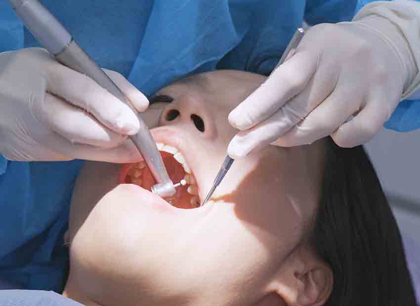 Ultrasonic Teeth Scaling