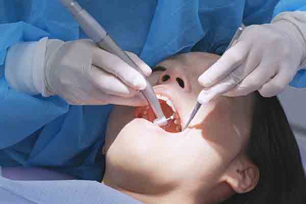 Ultrasonic Teeth Scaling